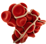 Image result for thromboembolism